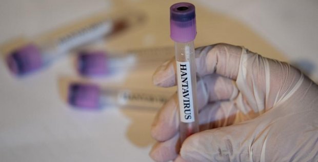 Kanada'da bir kişinin hantavirüs testi pozitif çıktı