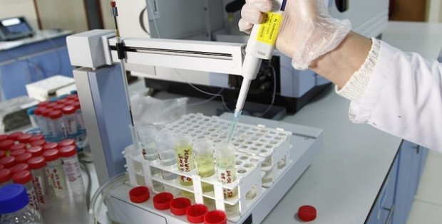 Kök hücre ile bir hasta daha AIDS'i yendi