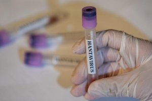 Kanada'da bir kişinin hantavirüs testi pozitif çıktı